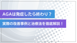 AGAは発症したら終わり？実際の改善事例と治療法を徹底解説！