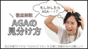 AGAの見分け方は？セルフチェック・診断方法・他の脱毛症との違いを徹底解説