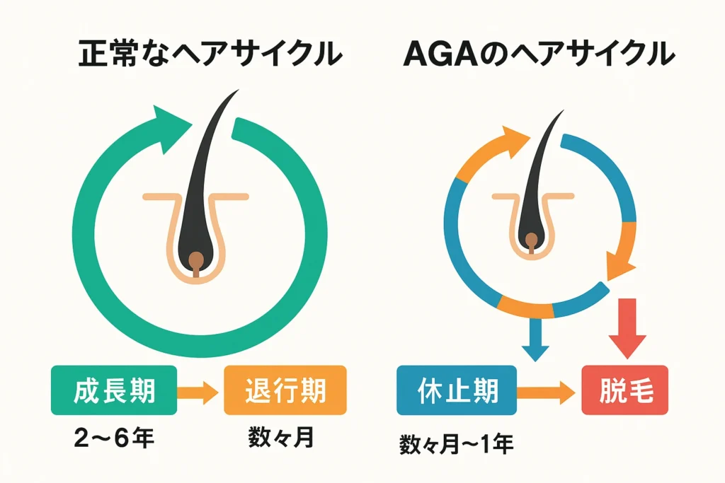 正常なヘアサイクルとAGAのヘアサイクル