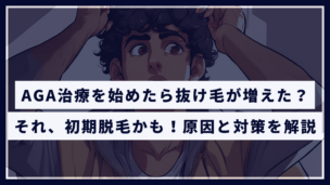 「AGA初期脱毛」とは？いつまで続く？原因と対策を徹底解説！