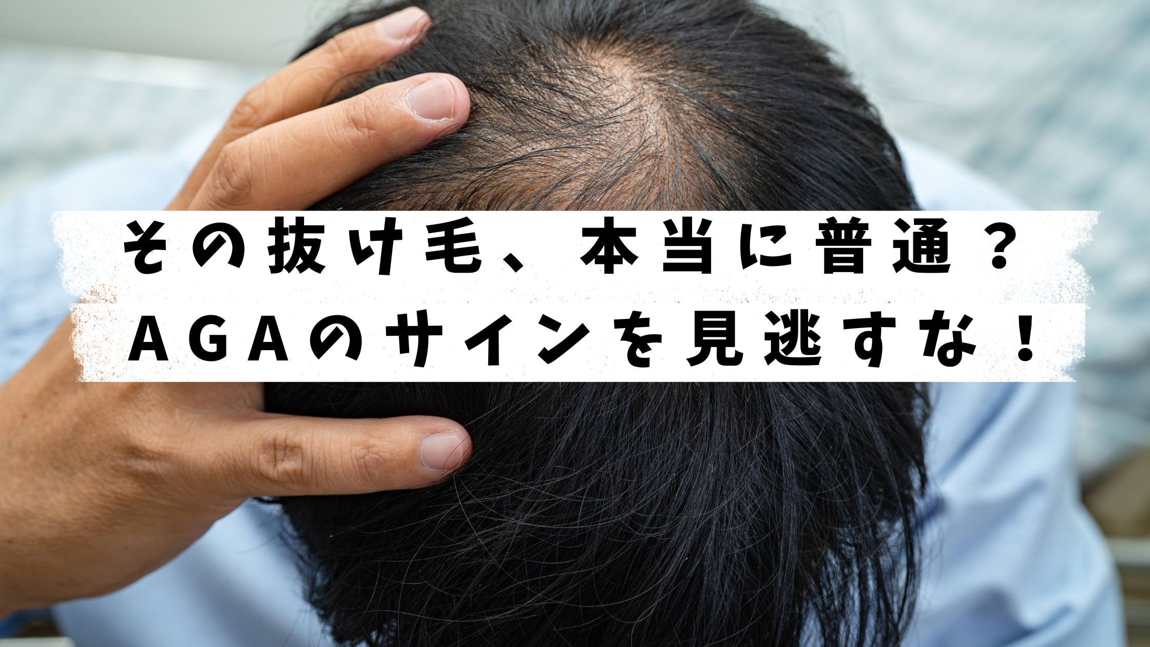 AGAの抜け毛と普通の抜け毛の違いは?見分け方&改善策を詳しく解説